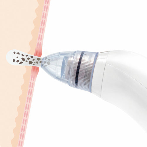 Limpador Facial Elétrico de Pontos Negros